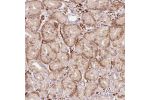 Immunohistochemical staining of human stomach, lower shows moderate cytoplasmic positivity in glandular cells.