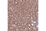 Immunohistochemical staining of human stomach, upper shows strong cytoplasmic positivity in glandular cells.