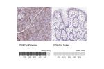 Immunohistochemistry analysis in human pancreas and colon tissues using Anti-PDIA2 antibody. Corresponding PDIA2 RNA-seq data are presented for the same tissues.