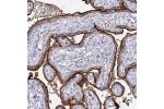 Immunohistochemical staining of human placenta shows strong membranous positivity in trophoblastic cells.