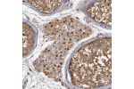 Immunohistochemical staining of human testis shows strong nuclear positivity in Leydig cells.