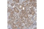 Immunohistochemical staining of human salivary gland shows strong membranous positivity in glandular cells.