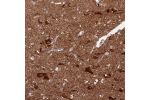 Immunohistochemical staining of human Cerebral cortex shows strong cytoplasmic positivity in neuronal cells and neuropil.