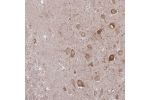 Immunohistochemical staining of human hippocampus shows moderate positivity in subsets of neuronal cells.