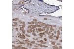 Immunohistochemical staining of human kidney shows strong cytoplasmic positivity in renal tubules.