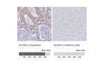 Immunohistochemistry analysis in human duodenum and cerebral cortex tissues using HPA051805 antibody. Corresponding SLC5A1 RNA-seq data are presented for the same tissues.