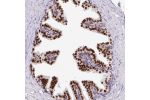 Immunohistochemical staining of human prostate shows strong nuclear positivity in glandular cells.