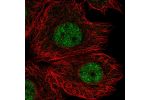 Immunofluorescent staining of human cell line MCF7 shows localization to nucleoplasm.