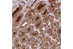Immunohistochemical staining of human stomach, upper shows distinct cytoplasmic and membranous positivity in glandular cells.