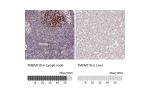 Immunohistochemistry analysis in human lymph node and liver tissues using HPA051870 antibody. Corresponding TMEM119 RNA-seq data are presented for the same tissues.