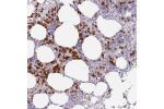 Immunohistochemical staining of human bone marrow shows strong cytoplasmic positivity in hematopoietic cells.