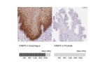 Immunohistochemistry analysis in human esophagus and prostate tissues using HPA051895 antibody. Corresponding FABP5 RNA-seq data are presented for the same tissues.