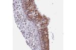 Immunohistochemical staining of human nasopharynx shows strong cytoplasmic and nuclear positivity in respiratory epithelial cells.