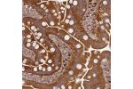 Immunohistochemical staining of human small intestine shows strong cytoplasmic positivity in glandular cells.