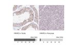 Immunohistochemistry analysis in human testis and pancreas tissues using HPA052003 antibody. Corresponding PARP2 RNA-seq data are presented for the same tissues.