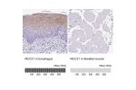 Immunohistochemistry analysis in human esophagus and skeletal muscle tissues using HPA052028 antibody. Corresponding MUC21 RNA-seq data are presented for the same tissues.