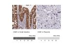 Immunohistochemistry analysis in human small intestine and placenta tissues using HPA052033 antibody. Corresponding DAB1 RNA-seq data are presented for the same tissues.