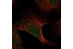 Immunofluorescent staining of human cell line U-2 OS shows localization to nucleoplasm & vesicles.