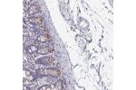 Immunohistochemical staining of human small intestine shows strong cytoplasmic positivity in Paneth cells.