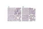 Immunohistochemistry analysis in human testis and pancreas tissues using Anti-PUF60 antibody. Corresponding PUF60 RNA-seq data are presented for the same tissues.