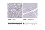 Immunohistochemistry analysis in human parathyroid gland and pancreas tissues using Anti-TRPM7 antibody. Corresponding TRPM7 RNA-seq data are presented for the same tissues.