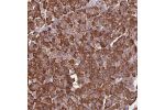 Immunohistochemical staining of human pancreas shows strong cytoplasmic positivity in exocrine glandular cells.