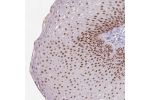 Immunohistochemical staining of human rectum shows strong nuclear positivity in glandular cells.