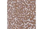Immunohistochemical staining of human liver shows moderate cytoplasmic positivity in hepatocytes.