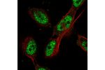 Immunofluorescent staining of human cell line U-251 MG shows localization to nucleoplasm.