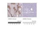 Immunohistochemistry analysis in human stomach and pancreas tissues using HPA052407 antibody. Corresponding GSDMB RNA-seq data are presented for the same tissues.