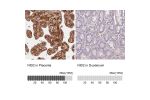 Immunohistochemistry analysis in human placenta and duodenum tissues using HPA052460 antibody. Corresponding NID2 RNA-seq data are presented for the same tissues.