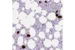 Immunohistochemical staining of human bone marrow shows strong cytoplasmic positivity in megakaryocytes.