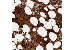 Immunohistochemical staining of human bone marrow shows strong cytoplasmic positivity in hematopoietic cells.
