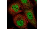 Immunofluorescent staining of human cell line A-431 shows localization to nucleoplasm & cytosol.