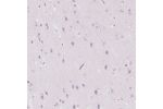 Immunohistochemical staining of human cerebral cortex shows no positivity in neurons as expected.