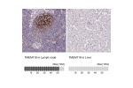 Immunohistochemistry analysis in human lymph node and liver tissues using HPA052650 antibody. Corresponding TMEM119 RNA-seq data are presented for the same tissues.