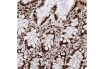 Immunohistochemical staining of human rectum shows strong nuclear positivity in glandular cells.