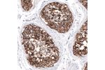 Immunohistochemical staining of human testis shows strong membranous positivity in cells in seminiferous ducts.