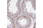 Immunohistochemical staining of human testis shows membrane positivity in seminiferus ducts.
