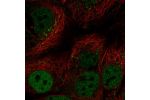 Immunofluorescent staining of human cell line CACO-2 shows localization to nucleoplasm & vesicles.
