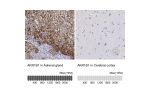 Immunohistochemistry analysis in human adrenal gland and cerebral cortex tissues using Anti-AKR1B1 antibody. Corresponding AKR1B1 RNA-seq data are presented for the same tissues.