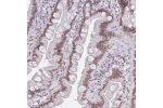Immunohistochemical staining of human small intestine shows strong nuclear positivity in glandular cells.