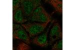 Immunofluorescent staining of human cell line CACO-2 shows localization to nucleoplasm.