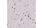 Immunohistochemical staining of human cerebral cortex shows strong nuclear positivity in neuronal cells.