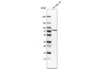 Western blot analysis in human cell line SK-MEL-30.