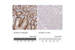 Immunohistochemistry analysis in human stomach and liver tissues using HPA052891 antibody. Corresponding SLC9A1 RNA-seq data are presented for the same tissues.