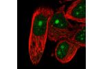 Immunofluorescent staining of human cell line PC-3 shows localization to nucleus & nucleoli.