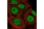 Immunofluorescent staining of human cell line MCF7 shows localization to nucleoplasm & vesicles.