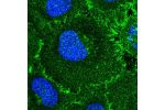Immunofluorescent staining of human cell line HeLa shows localization to plasma membrane.