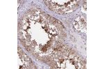 Immunohistochemical staining of human testis shows distinct cytoplasmic positivity in subsets of cells.